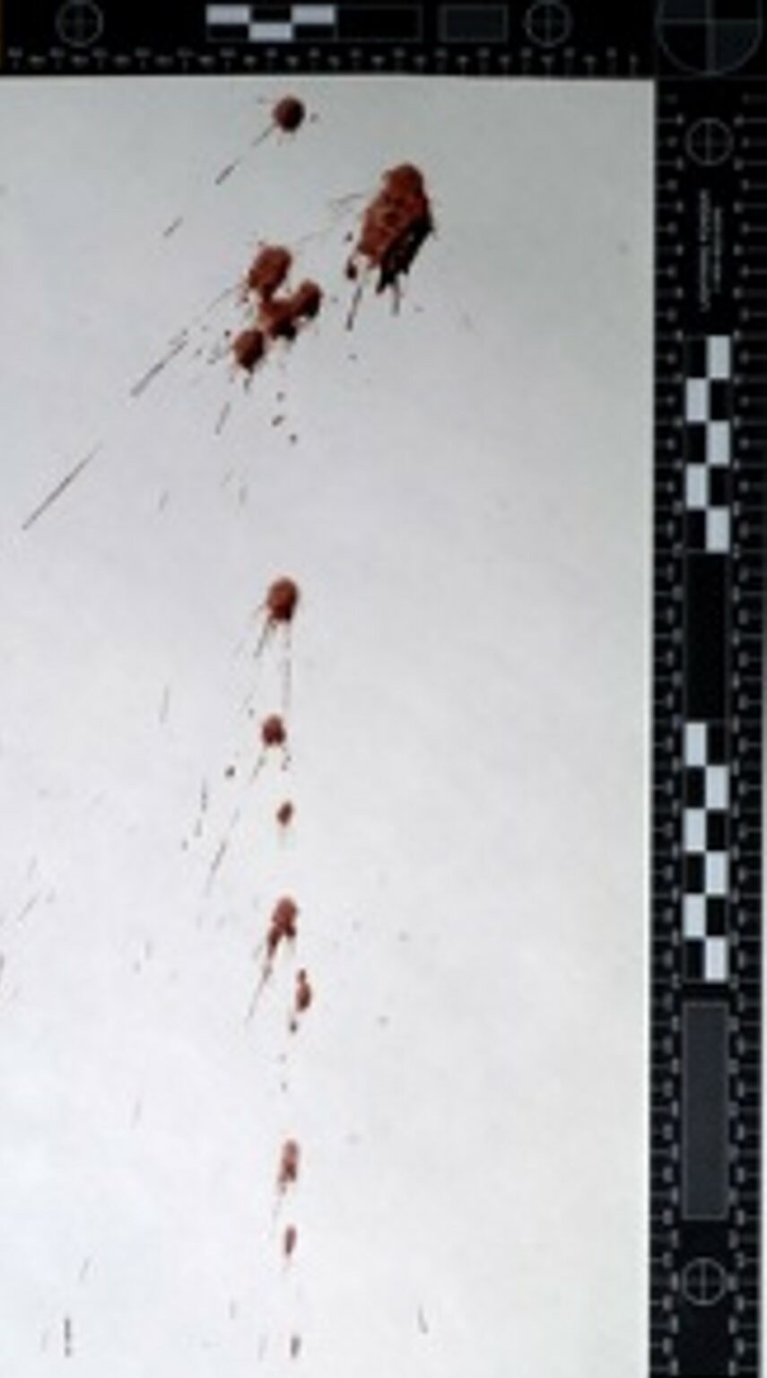 blood-spatter-pattern-analysis-ucvision