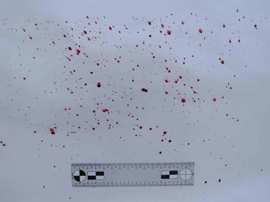 blood-spatter-pattern-analysis-ucvision